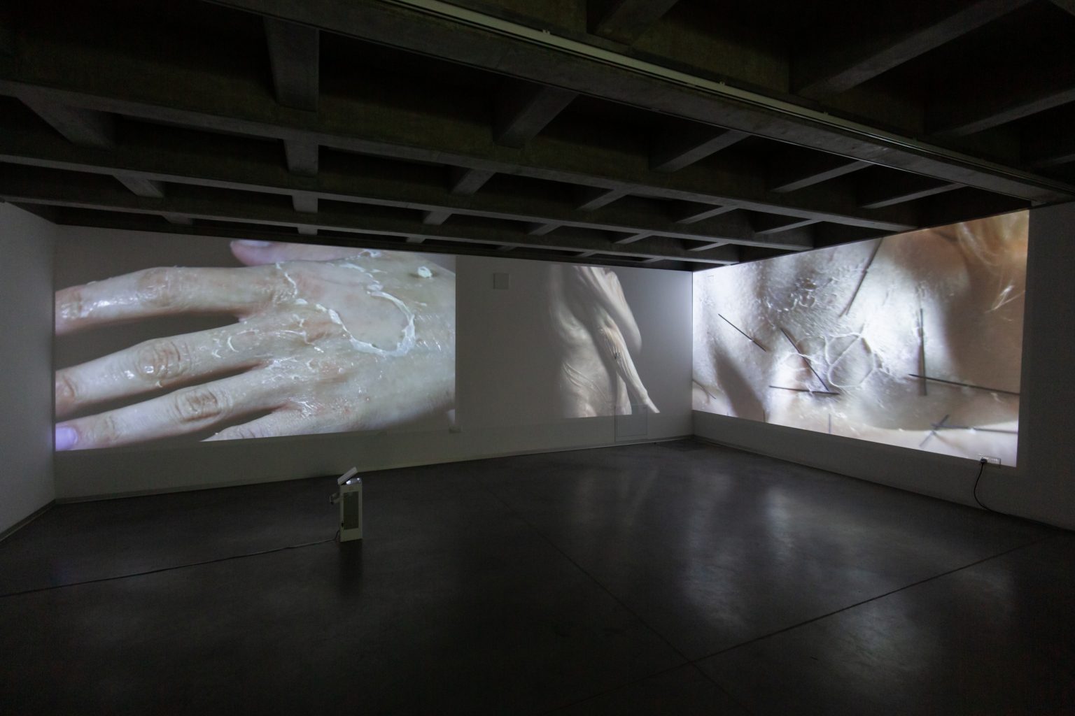 Wyświetlane na ścianach sali wystawowej zdjęcia przedstawiają zbliżenie ludzkiej dłoni oraz zbliżenie ciała ludzkiego